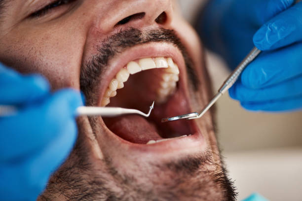 Best Emergency Denture Repair in Sans Souci, SC